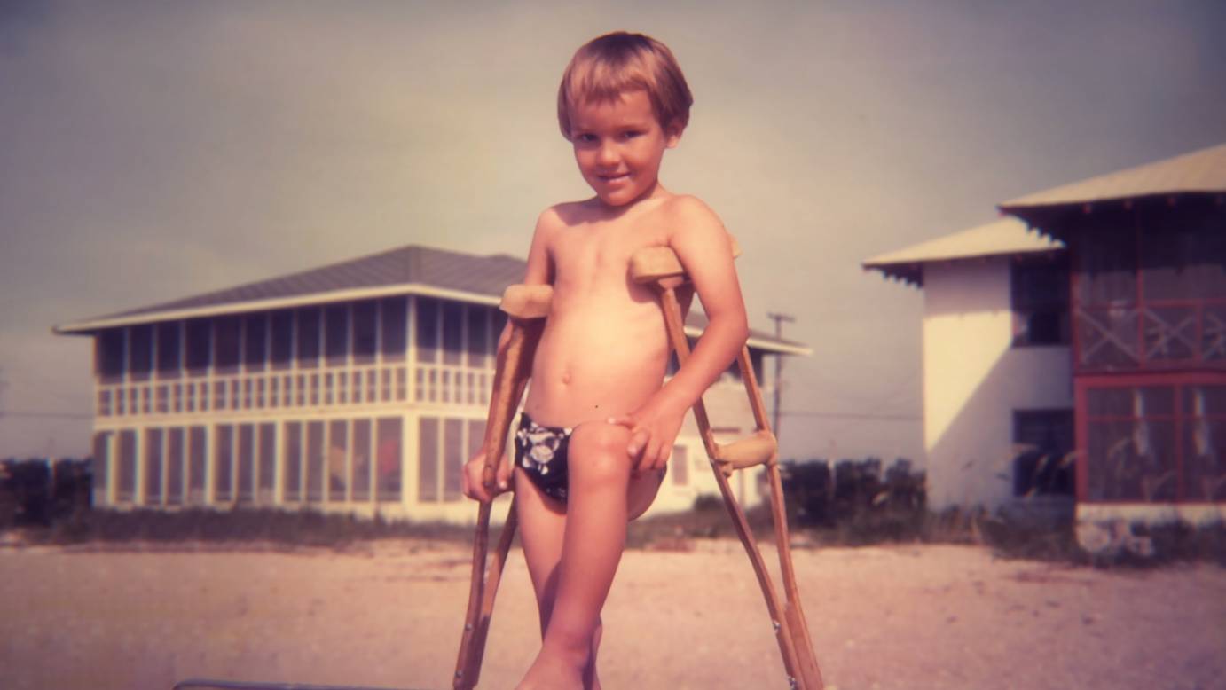 Bill Shannon as toddler at the beach with his crutches